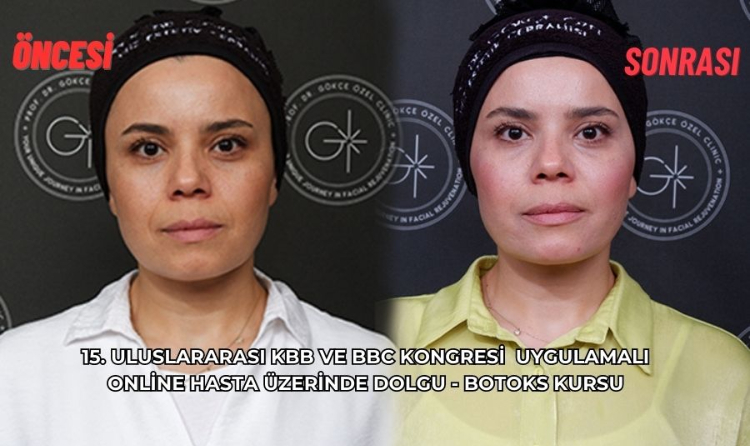 15. Uluslararası KBB ve BBC  Kongresi,  Uygulamalı Online Hasta Üzerinde Dolgu- Botoks Kursu